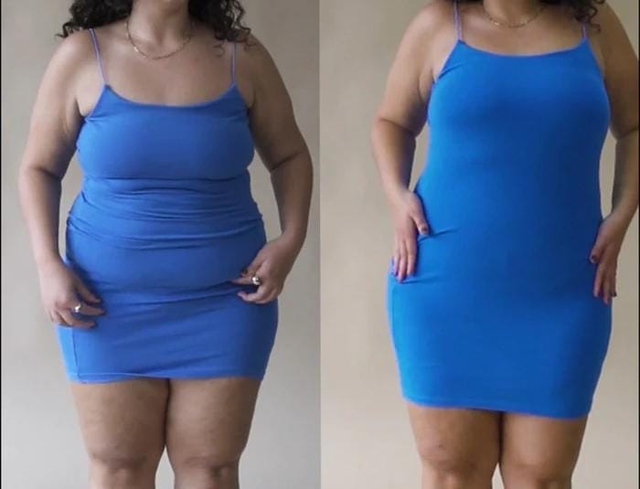 Antes e depois 1