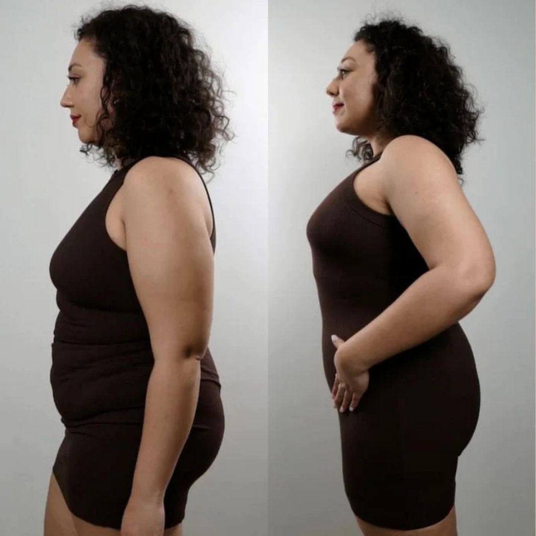 Antes e depois 2